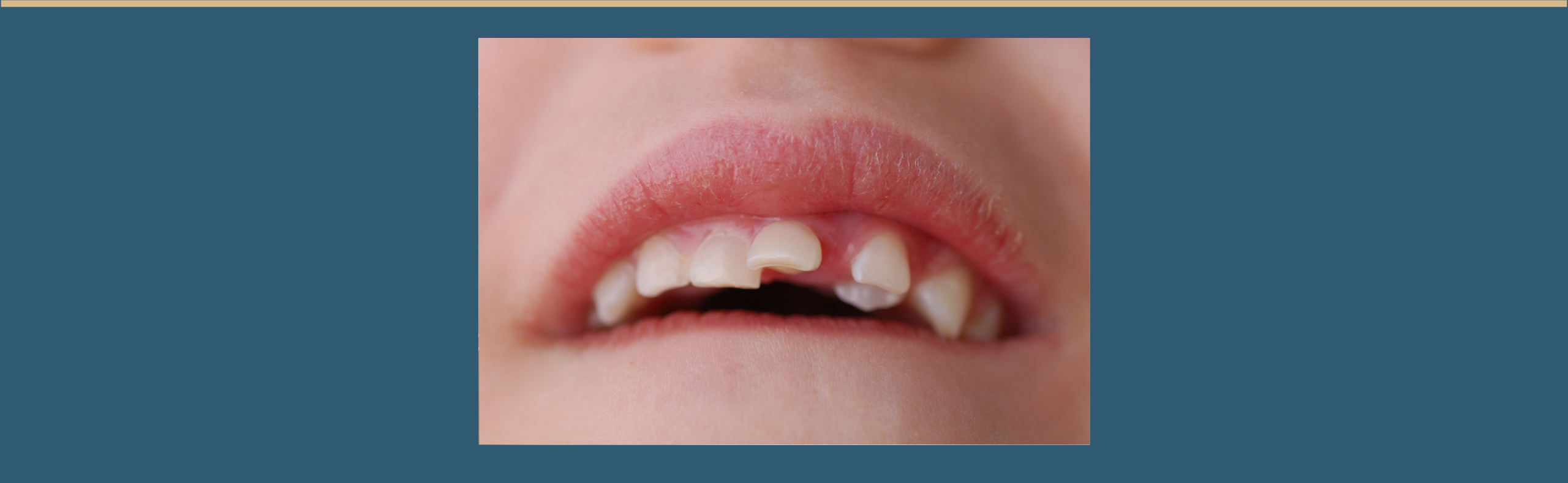 Dental first aid for a dislodged tooth (downloadable guide)