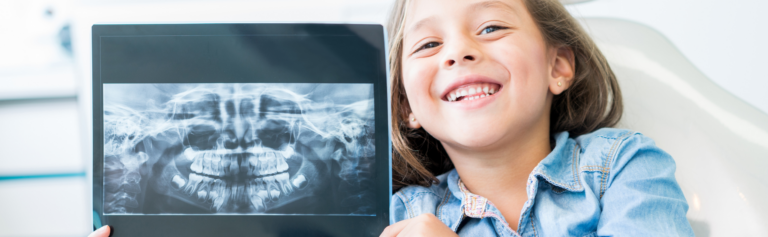 How Often Should I Have Dental X-rays (Radiographs)?